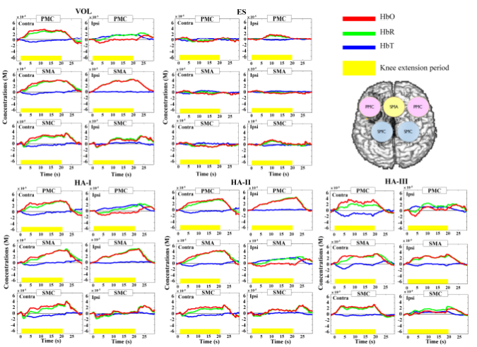 血红蛋白皮质区域变化的浓度 血红蛋白皮质区域变化的浓度